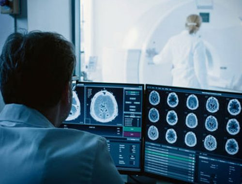 AI In Medical Imaging: A Diagnostic Enabler